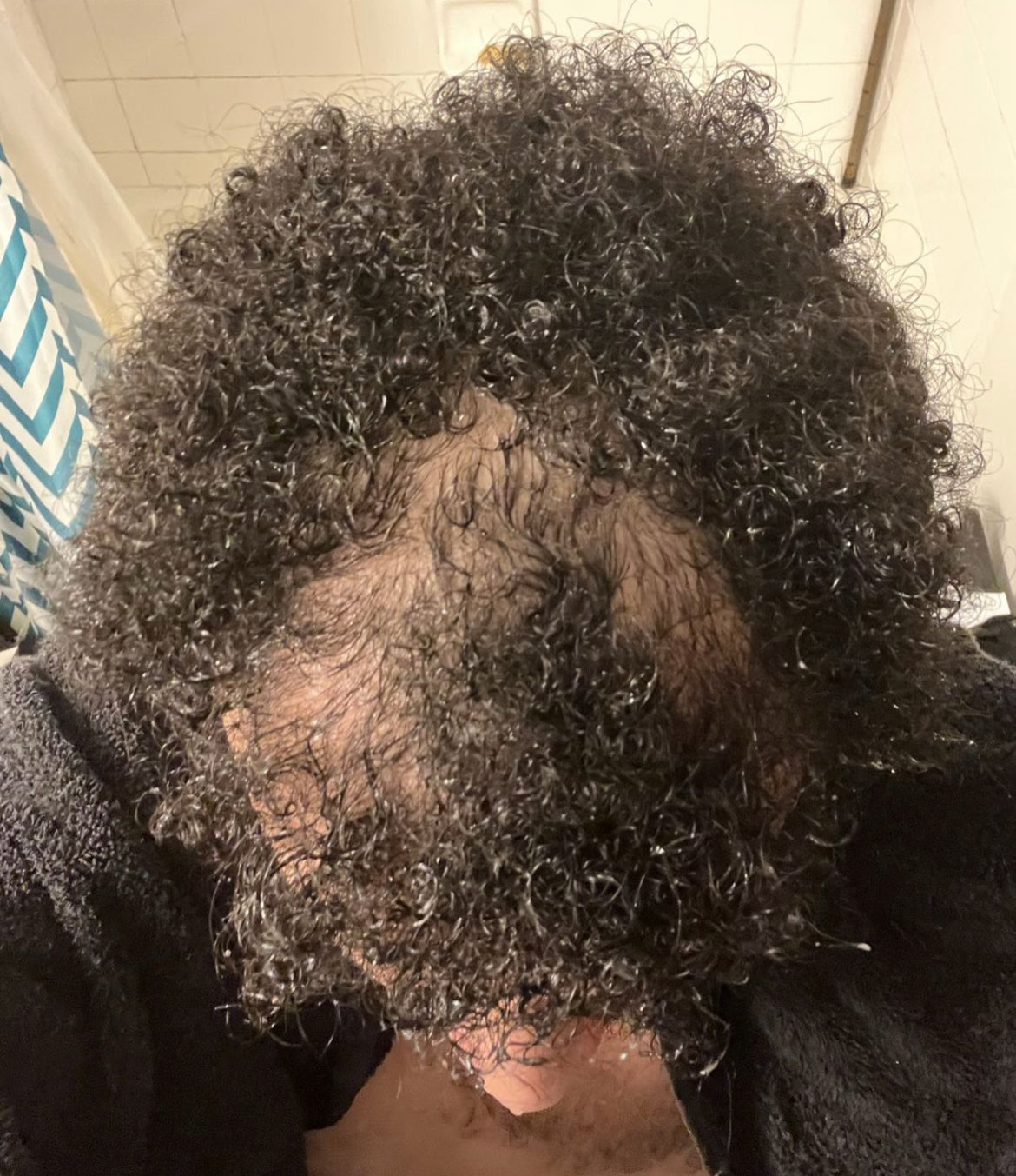 Hair growth serum